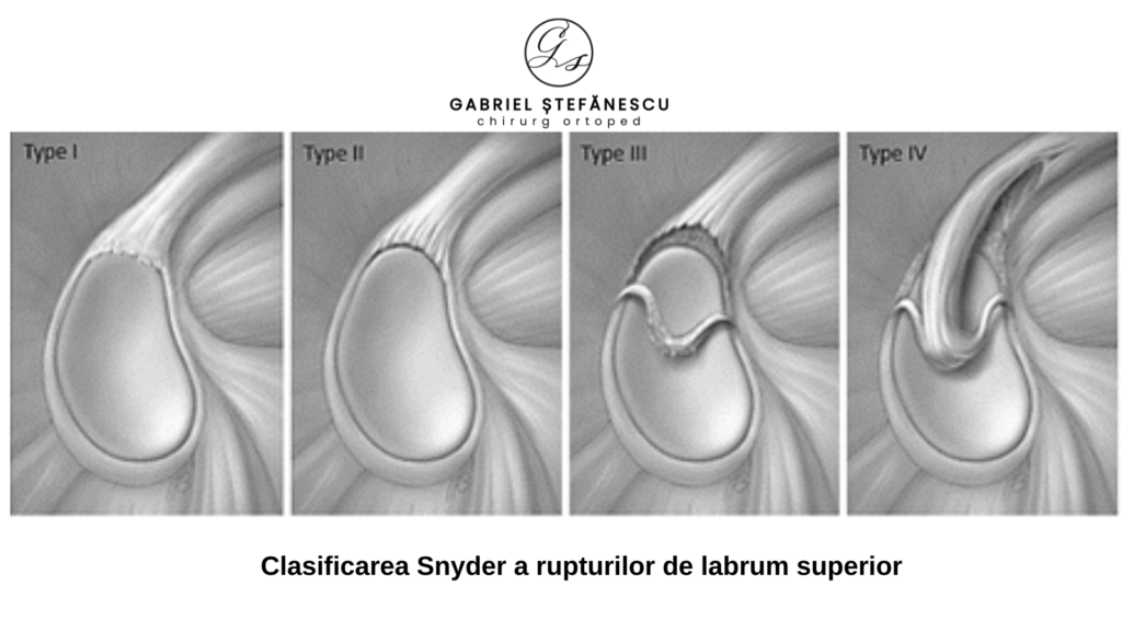 slap dr stefanescu gabriel