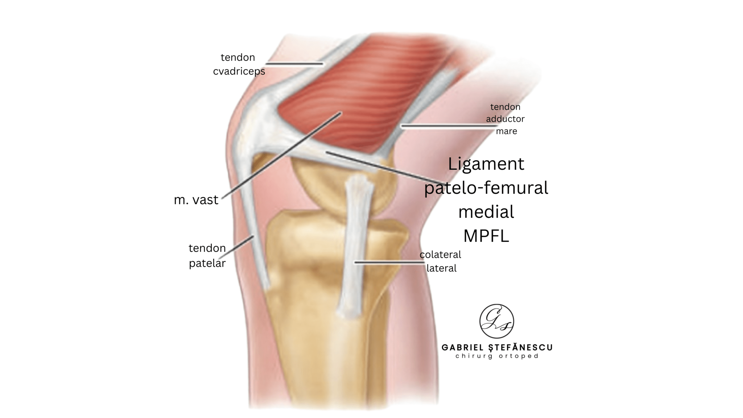 MPFL DR STEFANESCU