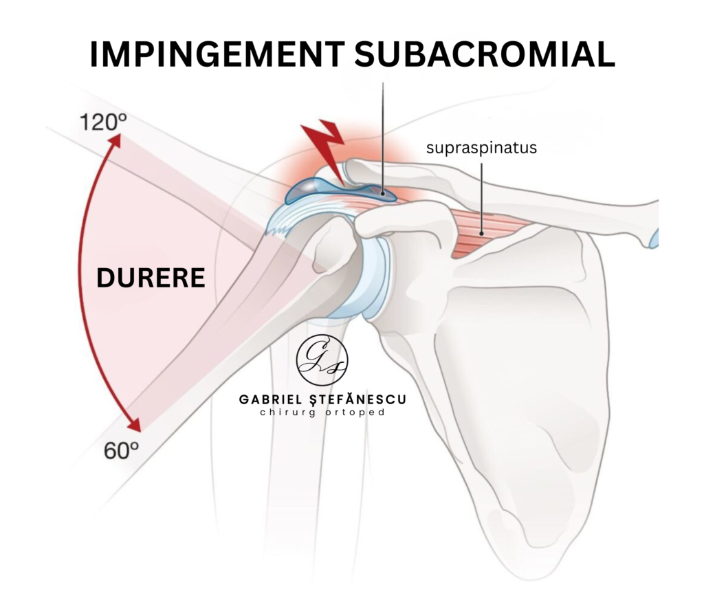 durere de umar