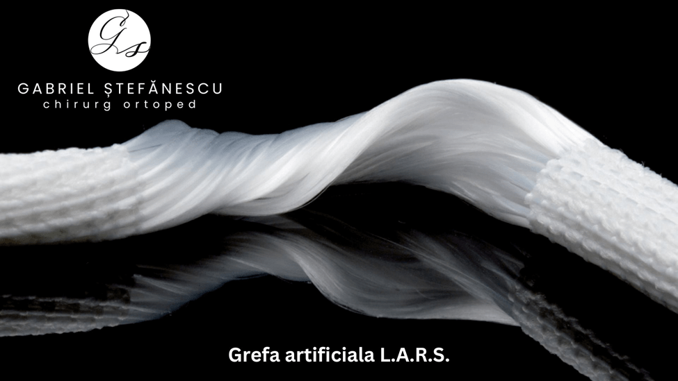 ligament artificial LARS dr stefanescu